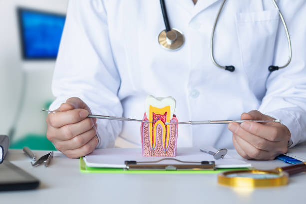 Best Emergency Root Canal Treatment in Longboat Key, FL